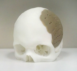 Промышленное производство биополимера для 3D-печати костей запустят в Томске